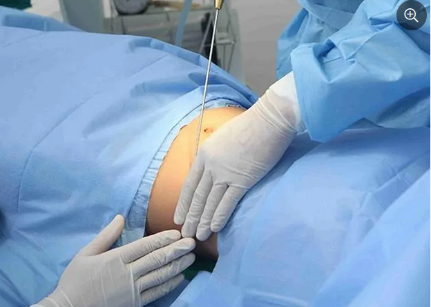 4 cơ sở “giảm béo” “chuẩn y khoa” vừa bị xử phạt